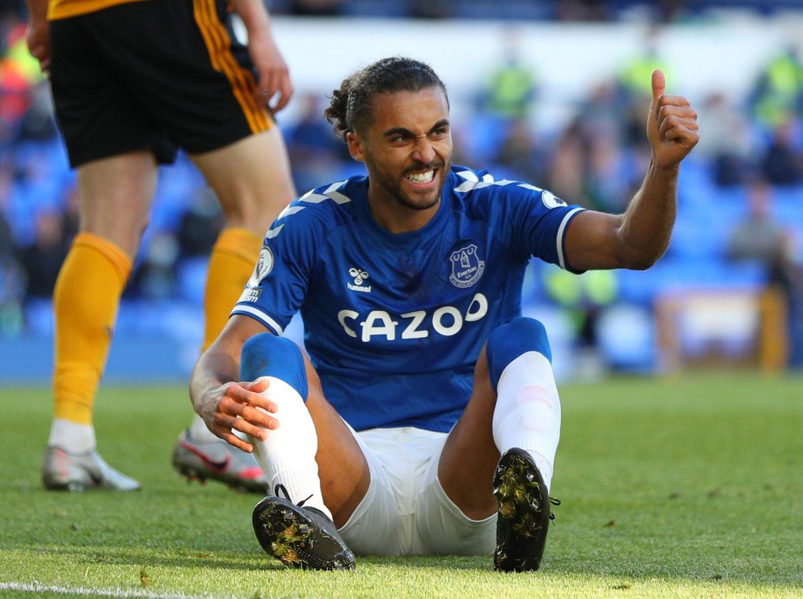 Calvert-Lewin suffers setback in recovery